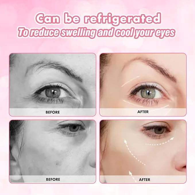 Under Eye Patches Silicone, 3 Pairs Reusable Under Eye Patches With Metal Eye Cream Applicator, Reusable Under Eye Mask Eye Pad For Minimize Fine Lines Wrinkles, Visible Metal Case-VivaGrace Women