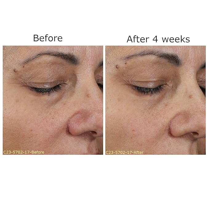 Daily Moisturizing Collection, Activator with Brightening Vitamin C+ Concentrate Starter, Hydrates & Brightens Face, Skin Care Rountine, For All Skin Type, Gift Bundle / Starter Kit-VivaGrace Women