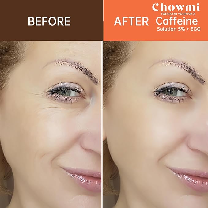 The Caffeine Solution 5% + EGCG，Reduces Appearance of Eye Contour Pigmentation and Puffiness，Under Eye Serum (30ml) Caffeine For Face Moisturizing Serum (2)-VivaGrace Women