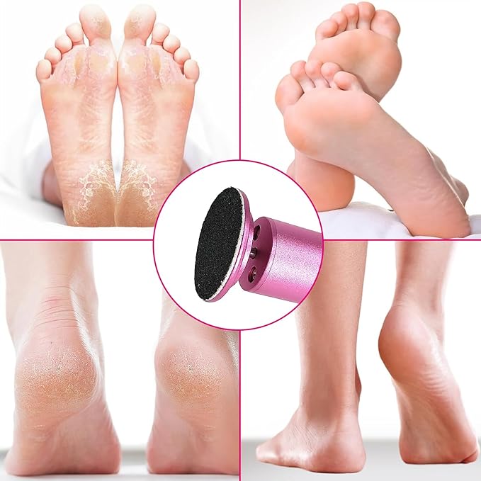 Electric Foot Callus Remover, Adjustable Foot Speed, Professional Foot Repair Tool, Equipped with 60 Pieces of Sandpaper, Suitable for Men and Women with Dead Skin calluses, Dry and Cracked, Pink-VivaGrace Women