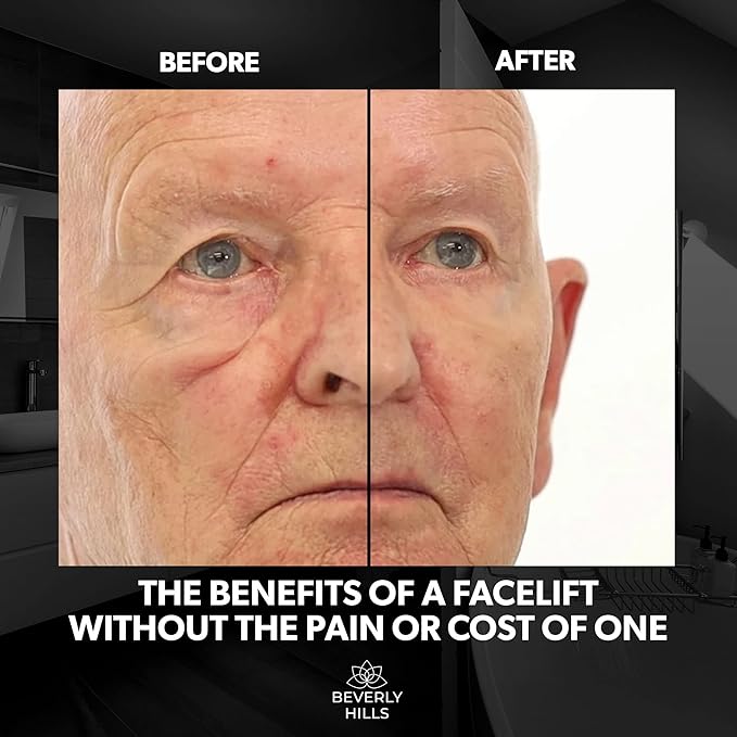 Beverly Hills Mens Instant Facelift and Eye Serum Treatment for Dark Circles, Puffy Eyes, and Wrinkles-VivaGrace Women