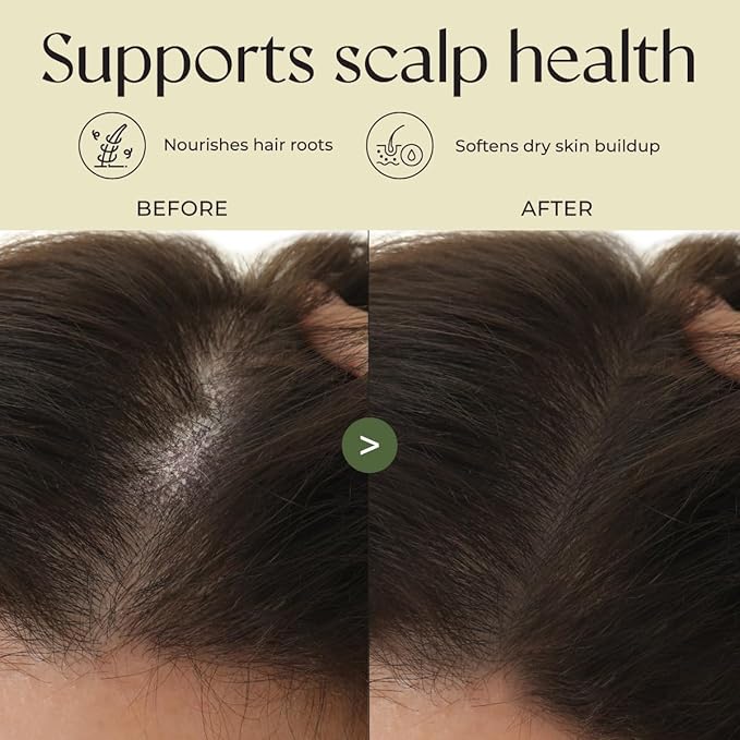 Gya Labs Rosemary & Castor Hair Growth & Styling Oil - 4 Fl Oz - Rosemary to Strengthen Hair - Protect & Tame Frizz, Dry Scalp - Hair & Scalp Hydration with 0.17 Fl Oz Deep Revival Argan Oil-VivaGrace Women