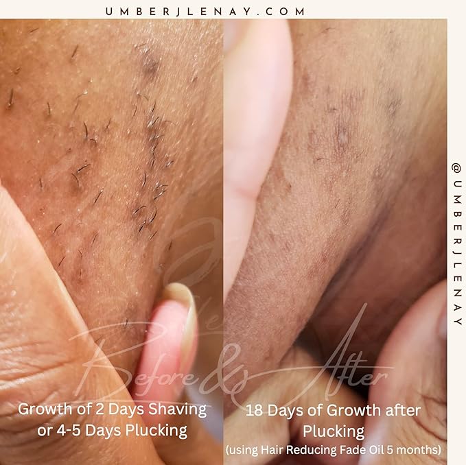 Hair Reducing Fade Oil – Regular Strength (Not sensitive skin), Minimizes Hair Growth for Face & Body – For Women & Men – 15ml Serum-VivaGrace Women