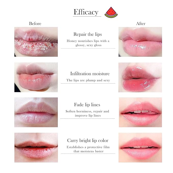 1 PCS Bee Lip Balm Honey Pot, Moisturizing Watermelon Sleeping Lip Balm Lip Mask Overnight, Hydrate Lip Repair Prevent Dry and Cracked Lip Care, Nourishes the Lip Skin, Reduces Lip Lines-VivaGrace Women