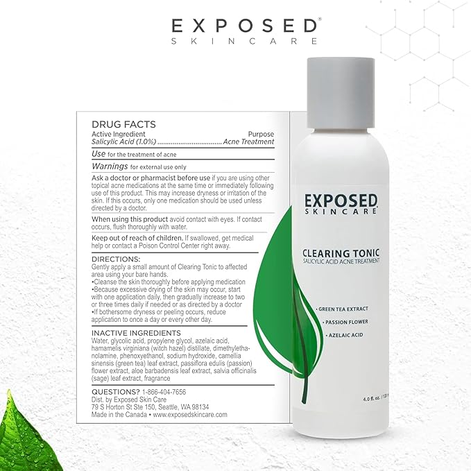 Exposed Skin Care Acne Treatment Kit - Includes Facial Cleanser, Clearing Tonic, Acne Treatment Serum, Clear Pore Serum, Clarifying Mask, Cloth - Natural Acne Solution for Face, All Ages & Skin Types-VivaGrace Women