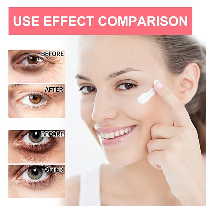 Retinol Eye Serum Stick, Retinol Eye Cream and Gel, Anti-Aging Eye Treatment-VivaGrace Women