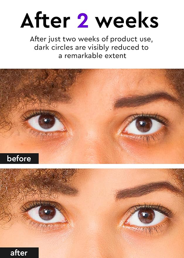 Bewants Eye Cream Stick for Wrinkles | Under Eye Cream For Dark Circles and Puffiness | Eye Cream for Puffiness and Bags Under Eyes | Hydrating Eye Cream for Sensitive Skin | Korean Skincare-VivaGrace Women