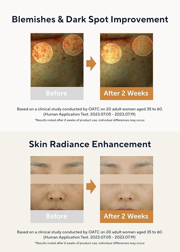 AROMATICA Glow Vita C Toning Serum Orange & Neroli 30ml/1.01 fl. oz - Orange Vitamin C Serum for Face with Hyaluronic Acid For Sensitive Skin-VivaGrace Women