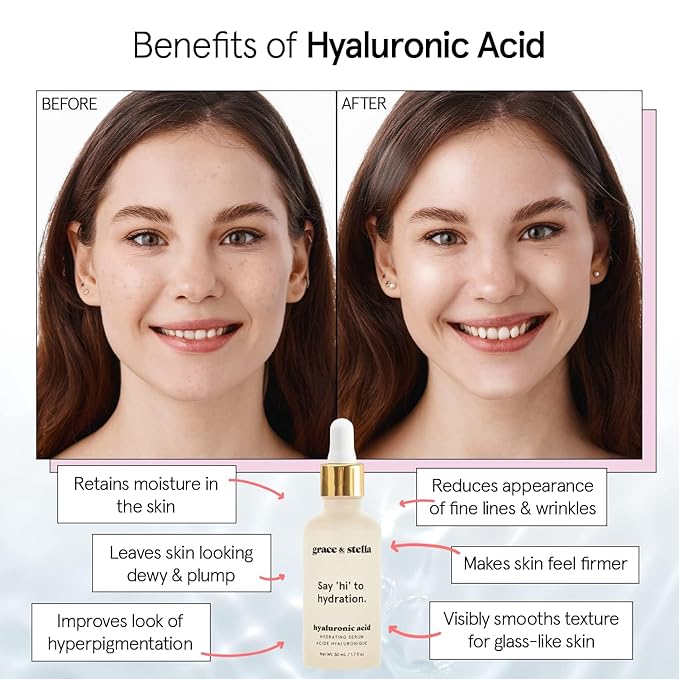 grace & stella Award Winning Hyaluronic Acid Serum (10ml/0.34 fl oz) Hyaluronic Acid Serum for Face - Acido Hialuronico Face Serums for Women - Hydrating, Remove Fine Lines, Wrinkles - Anti Aging-VivaGrace Women