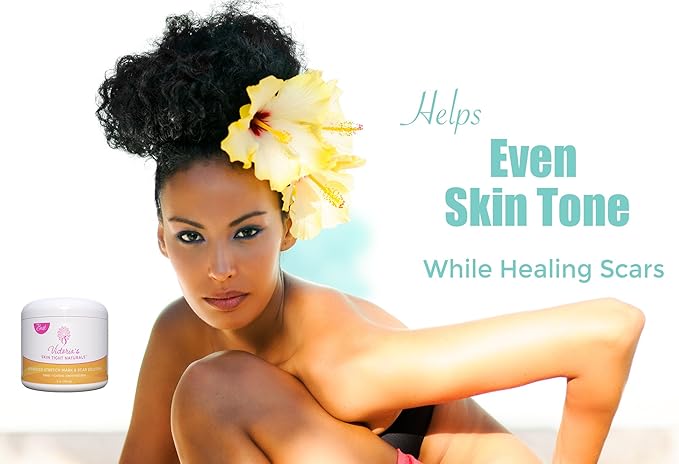 Best Stretch Marks Cream Prevent & Reduce Marks Reduce Pregnancy Stretch Marks Highly Concentrated Cream includes $29 Scar Reducing Guide-VivaGrace Women