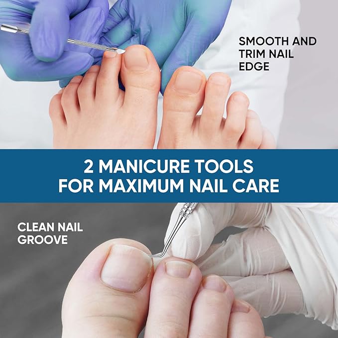 Ingrown Toenail Treatment, 60Pcs Ingrown Toenail Corrector Strips, Ingrown Toenail Removal Kit with File and Lifter, 60Pcs-VivaGrace Women