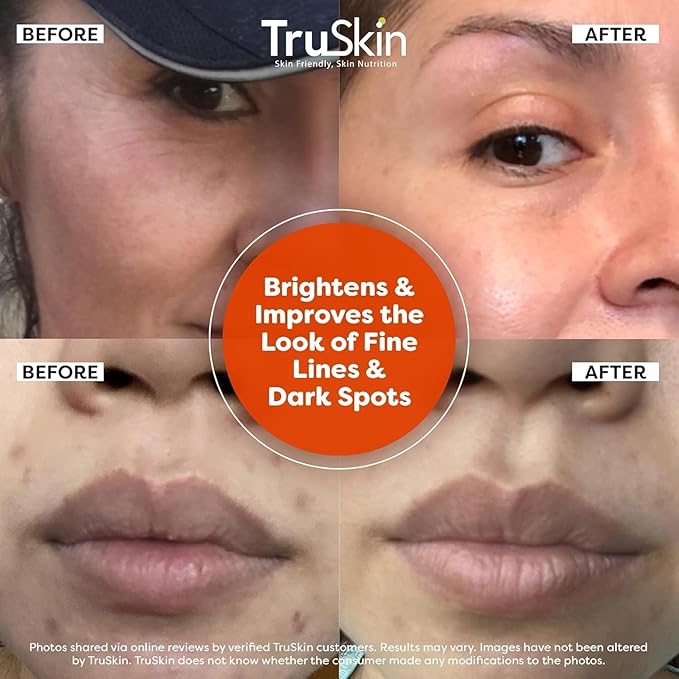 TruSkin Vitamin C Serum For Face – Anti Aging Face Serum with Vitamin C, Hyaluronic Acid, Vitamin E – Brightening Formula – Improve Appearance of Dark Spots, Tone, Fine Lines & Wrinkles, 1 Fl Oz-VivaGrace Women