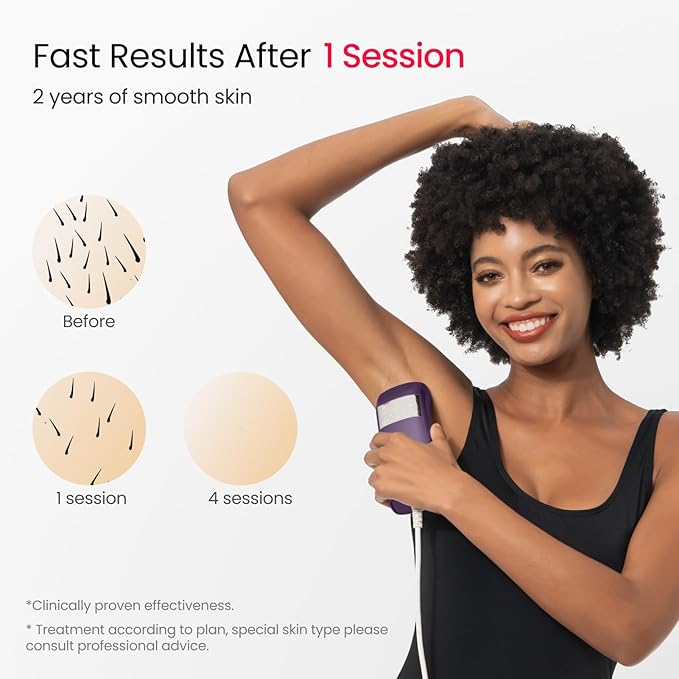 IPL Laser Hair Removal for Women and Men, 2 Lights, 2℃, 16.6 cm² Sapphire Ice Cooling for Sensitive Skin, 4-Pulse Mode for Ingrown Hair, Bikini, Face, Body Permanent Epilator Home Hair Removal Device-VivaGrace Women