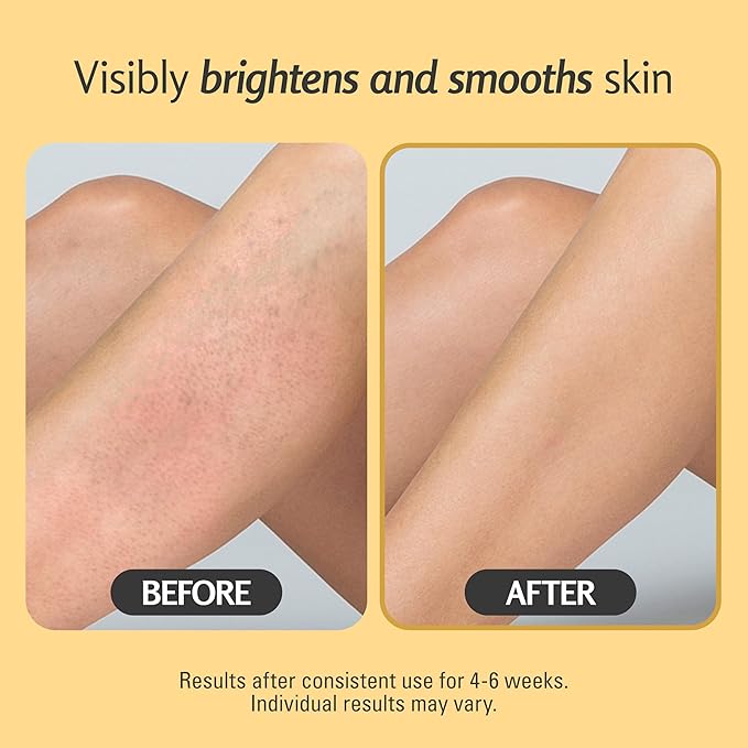 Exfoliating Turmeric Scrub and Skin Exfoliator with Collagen and Coconut Oil, Gently Exfoliates Face, Body, Hands, and Feet, Moisturizing Skincare, 16 oz by M3 Naturals-VivaGrace Women