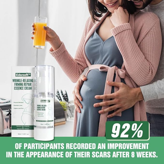 Wrinkle-Relaxing Firming Repair Essence Cream - Removes Maternity Stretch Marks, Prevents Wrinkles & Fine Lines, Nourishes & Rejuvenates Skin with Safe, Natural Formula-VivaGrace Women