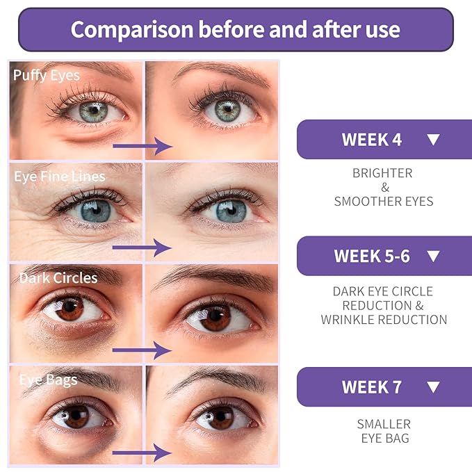 BREYLEE Retinol Eye Cream - Puffy Eyes and Dark Circles Treatments – Look Younger and Reduce Wrinkles and Fine Lines Undereye, Improve and Firm eye Skin - Pure Natural Material Extraction-VivaGrace Women