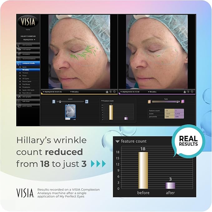 My Perfect Eyes 20ml, 200 Applications, Penny Lane, Instant Results, Clinically Proven, Anti-Ageing Serum UK Original Formula, Science-Backed Anti-Wrinkle Serum. As Seen on TV.-VivaGrace Women