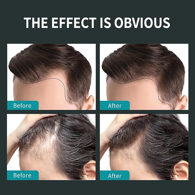 Sevich Hair Fiber Thickener Spray - Instant Hair Thickening Powder for Men & Women, Root Touch Up Hair Color, Hair Building Fibers for Thinning Hair, Waterproof, Sweatproof, Natural Look,120ml Black-VivaGrace Women