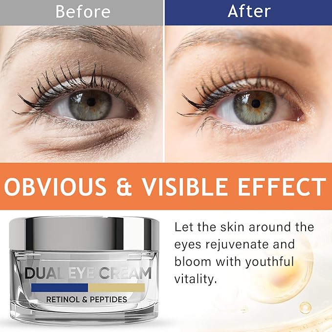 Eye Cream, Dual Eye Cream Anti Aging with Advanced Retinol and Peptides, Under Eye Cream for Dark Circles, Fine Lines, Puffiness and Bags Under Eyes-VivaGrace Women