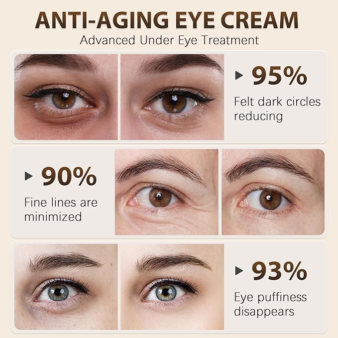 Vitality-Fill Boosting Eye Cream, Natural Anti Aging Under Eye Cream Lift & Firm,Reduce Wrinkles,Fine Lines,and Under Eye Bags,Dark Circles Under Eye Cream-VivaGrace Women