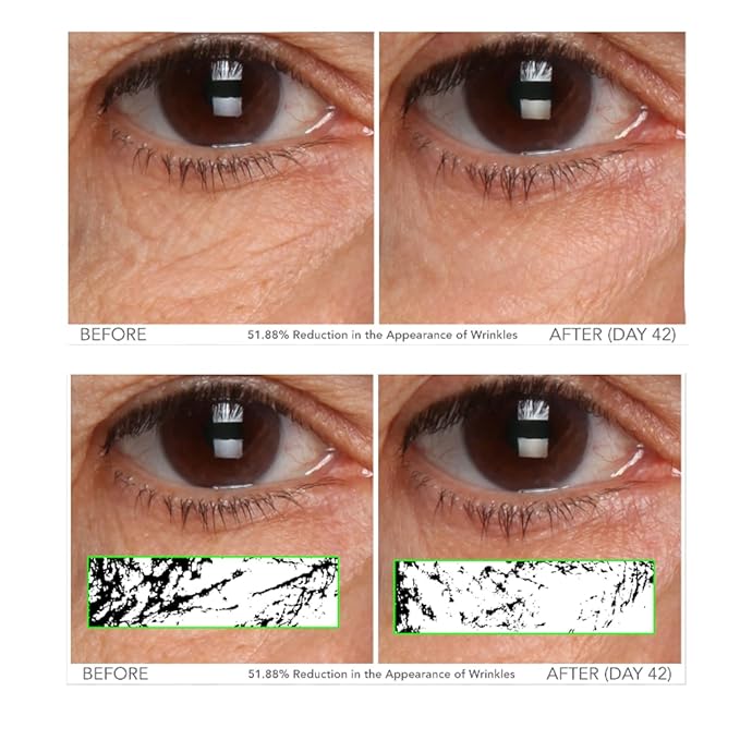 Serious Skincare - C3 Vitamin C Ester Eye Beauty Treatment with Hyaluronic Acid - For Dull & Dry Under Eyes - Soothing C3 Plasma Gel Formula for Fine Lines, Wrinkles, Discoloration - 0.5 oz.-VivaGrace Women