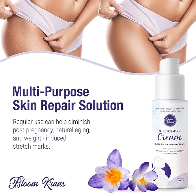 Bloom Krans Stretch Mark Cream for Pregnancy – Moisturizing Stretch Mark Remover Prevention Cream for the Pregnant Belly - Postpartum Lotion Essentials-VivaGrace Women