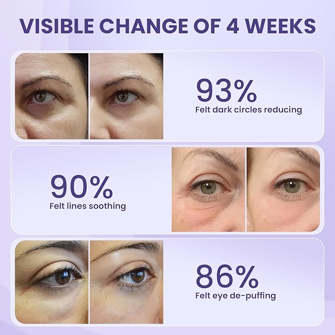 Retinol Eye Cream, Under Eye Cream for Dark Circles and Puffiness, Anti-Aging Eye Cream for Wrinkles, Eye Theatment with Lotus Leaf Extract, Made in USA-VivaGrace Women