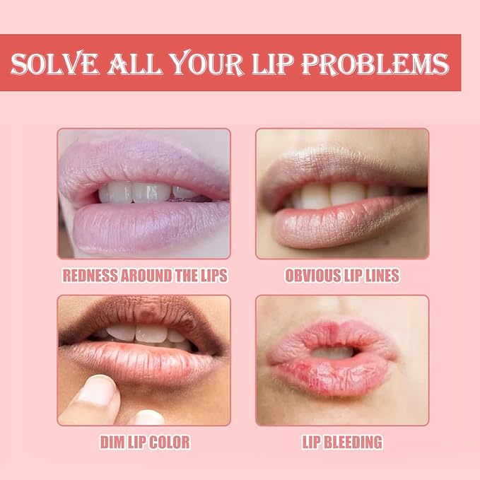 3 PCS Bee Lip Balm Honey Pot, Exfoliating Honey Strawberry Watermelon Lip Mask Overnight with Built-In Brush, Hydrating Prevention Dry and Crack Lip Scrubs Exfoliator Lip Wrinkle Care-VivaGrace Women