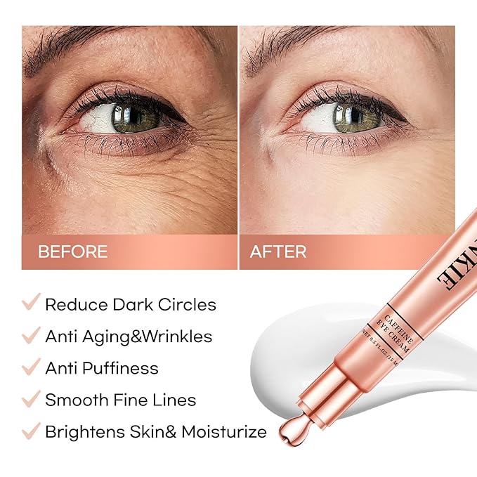 Eye Cream for Dark Circles and Puffiness: Caffeine - Retinol Cream- Anti Aging Wrinkles With Collagen Hyaluronic Acid Fine Lines Depuffer in 3-4 Weeks-15 mL-VivaGrace Women