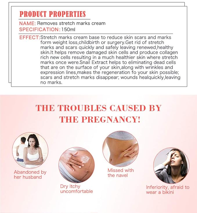 AICHUN BEAUTY Pregnancy Cream Streach Mark Remover Scars Repair Cellulites Lotion Cream 150ml-VivaGrace Women