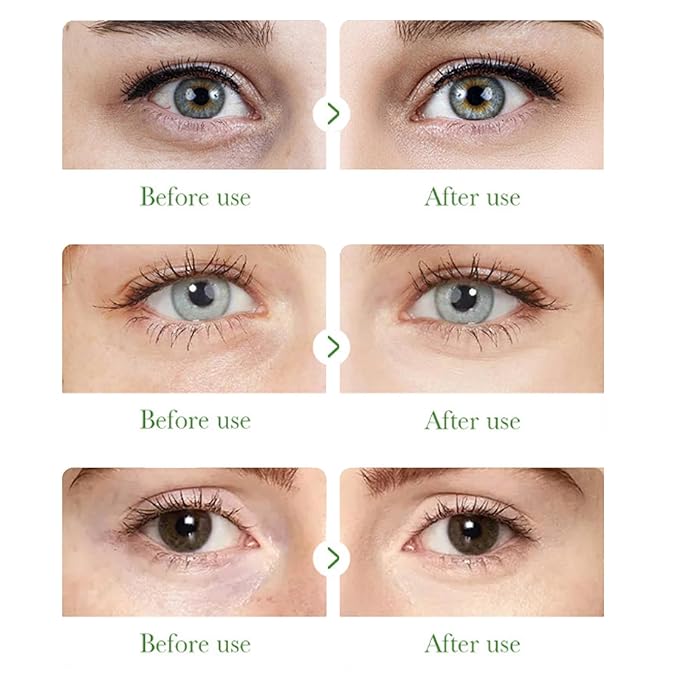 Aloe Vera Under Eye Mask,60 PCS Aloe Vera Gel Eye Mask Skin Care,Hyaluronic Acid Collagen Under Eye Patches for Dark Circles and Puffiness,Reduce Wrinkle Patches,Improves & Firms Eye Skin-VivaGrace Women