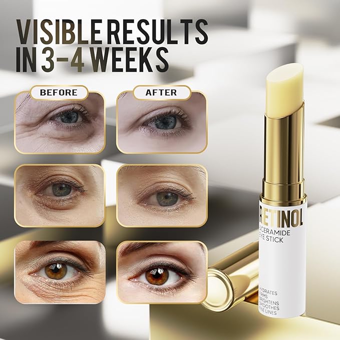 Retinol Eye Stick, Eye Cream for Dark Circles and Puffiness, Eye Brightening Cream for Hydration, Wrinkles in 3-4 Weeks, Travel Portability Anti-Aging Eye Cream for Bags Under Eye Reduces Fine Line-VivaGrace Women