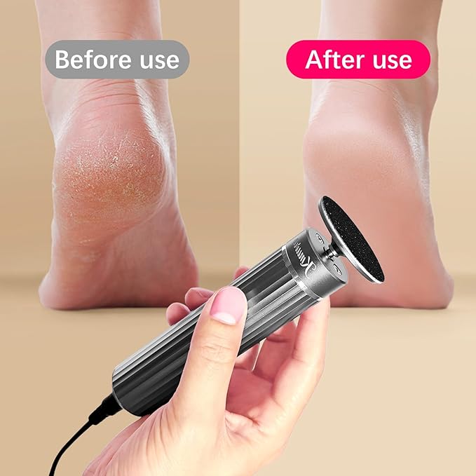 5.3'' Electric Foot Callus Remover with 80pcs Sandpaper Discs & Brush, Professional Aluminum Ergonomic Pedicure Tool, Stepless Speed & Reverse Control for Dead Skin Removal (Grey)-VivaGrace Women
