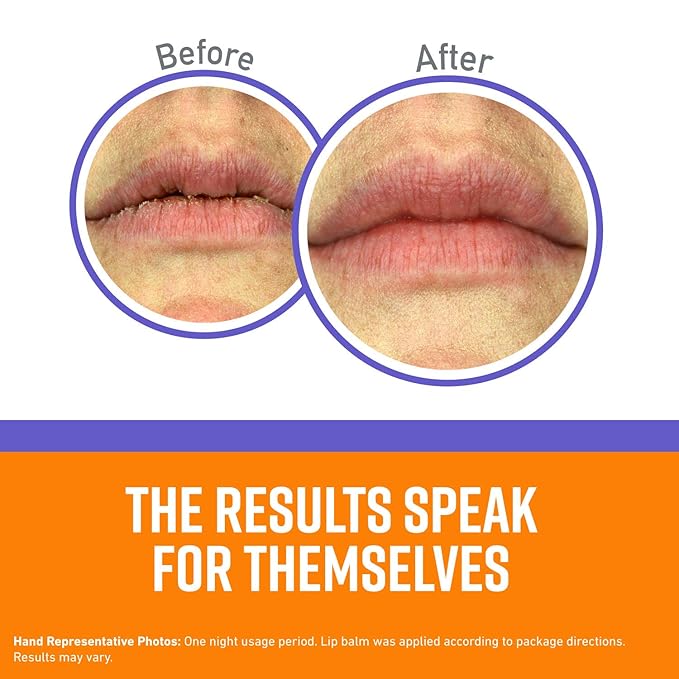 O'Keeffe's Lip Repair Night Treatment Lip Balm, 0.25 Ounce Jar, (Pack of 1)-VivaGrace Women