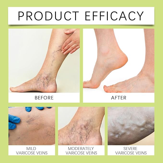 Miracle Balm, Soothing Balm for Joints, Back, Legs & Feet, Non-Greasy (3PCS)-VivaGrace Women