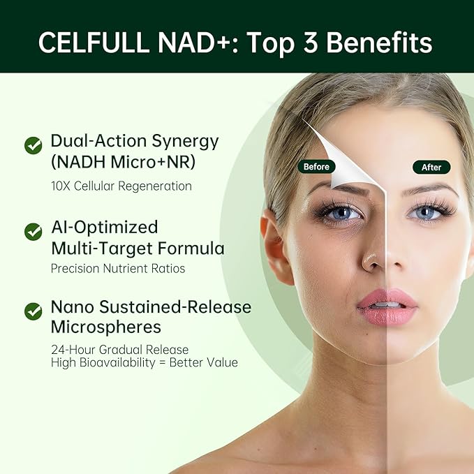 CELFULL NAD Supplement for Women with NADH,Resveratrol,Nicotinamide Riboside,Quercetin-NAD+ Boosting for Anti Aging Cellular Energy &Stamina-30000mg/Bottle-VivaGrace Women