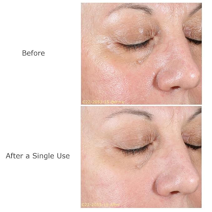 Daily Moisturizing Collection, Activator with Hydrating Vitamin B+ Concentrate Starter, Hydrates & Brightens Face, Skin Care Rountine, For All Skin Type, Gift Bundle/Starter Kit-VivaGrace Women