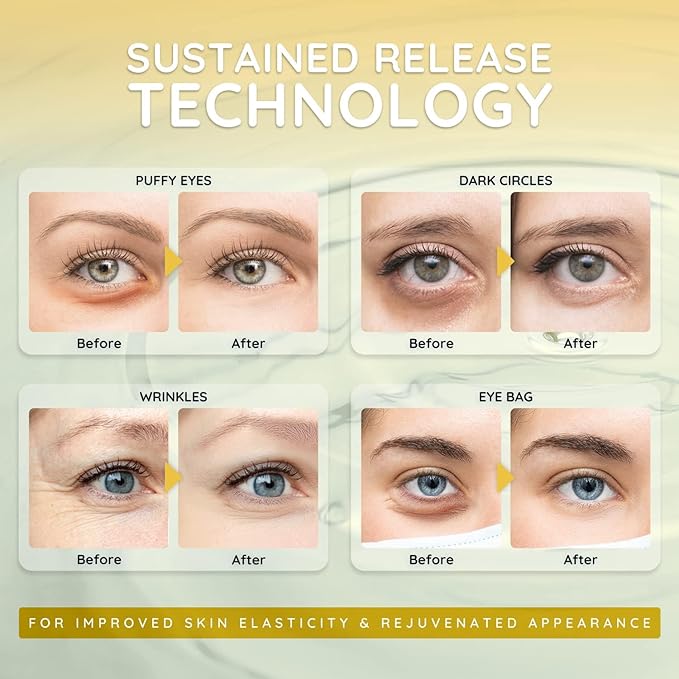 Enaskin Naturals Under Eye Patches for Dark Circles: Premium Gels Pads - Reduce Eye Bags, Wrinkles & Puffy - Skin Treatment Advanced Mask - Anti Aging & Face Moisturizer For Women, 10 Pairs (Black)-VivaGrace Women