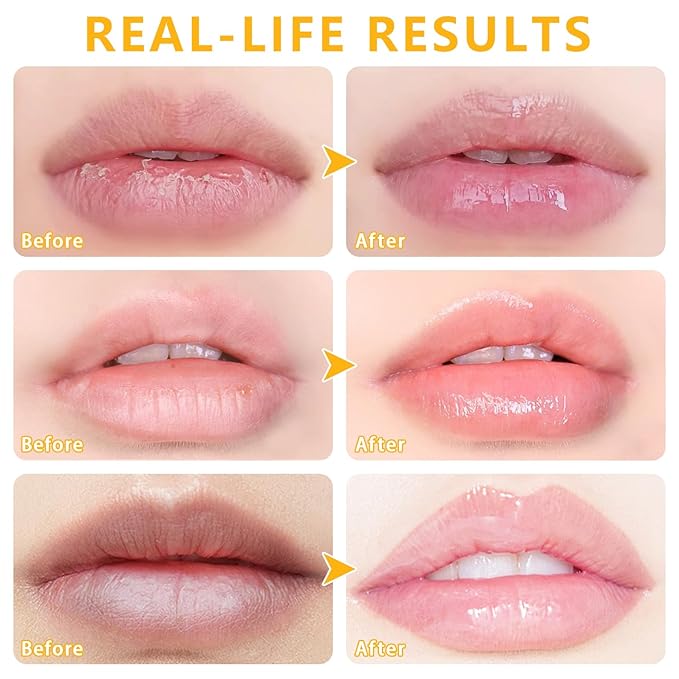 5 PCS Bee Balm Lip Balm Lip Mask Honey Pot, Lip Mask Propolis Moisturizing Lip Balm, Hydrating Prevention Dry and Cracked Lip Scrubs Exfoliator Lip Care (Strawberry&Watermelon&Honey&Apple Lime&Cherry)-VivaGrace Women