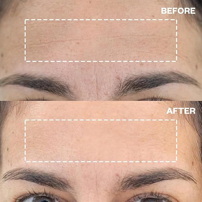 Wrinkles Schminkles Forehead Wrinkle Patches, 4-Pack, Reusable Hypoallergenic Silicone Smoothing Pads for Reducing Frown Lines & Face Lift Overnight-VivaGrace Women