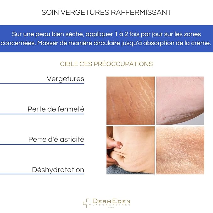 SPECIFIC PROTOCOLE STRETCH MARKS CARE FIRMING CREAM 200ML-VivaGrace Women