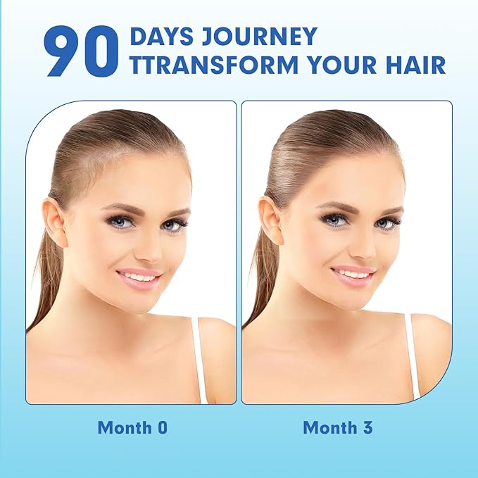 Postpartum Hair Loss Vitamin, Vegan Gummies with Biotin, Collagen, & Folate, Postpartum Hair Loss Products for Less Shedding, Thicker Hair, Stronger Hair, Breastfeeding-Friendly, 60 Gummies-VivaGrace Women