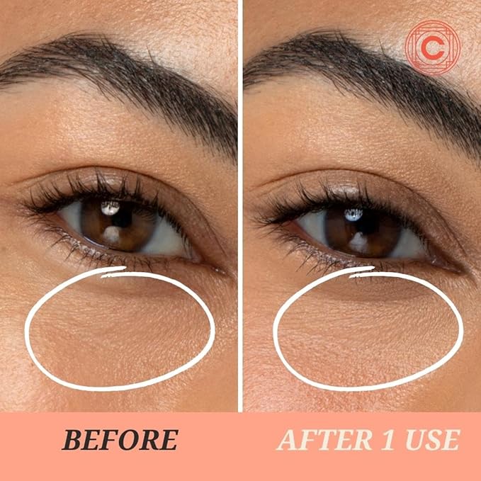 Lights On Brightening Dissolvable Eye Mask Infused with Red Algae, Vitamin C, Peptides, and Black Mulberry - Under Eye Patches for Wrinkles, Dark Circles, Puffiness, and Signs of Aging-VivaGrace Women