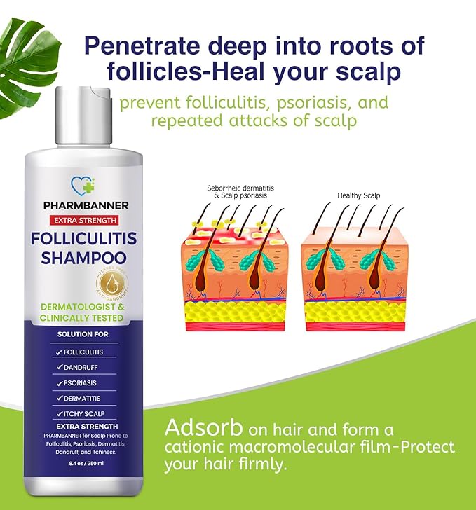 Anti-Fungal Shampoo for Itchy, Dry Scalp – Supports Scalp Health, Helps with Folliculitis, Seborrheic Dermatitis & Scalp Flaking-2 Pack-VivaGrace Women