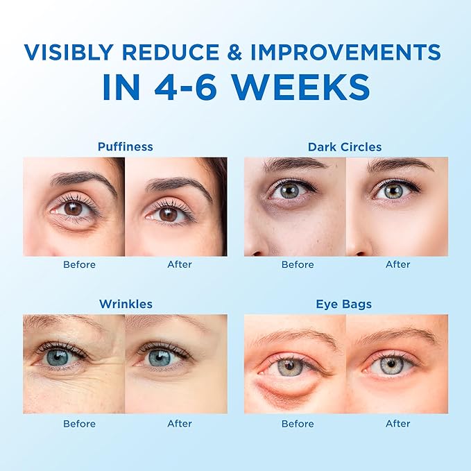 Eye Patches for Puffy Eyes 60 Pcs, 24k Gold Under Eye Patches for Dark Circles and Puffiness, Under Eye Mask Patches for Wrinkles, Dark Circles Under Eye Bags Treatment For Women And Men-VivaGrace Women