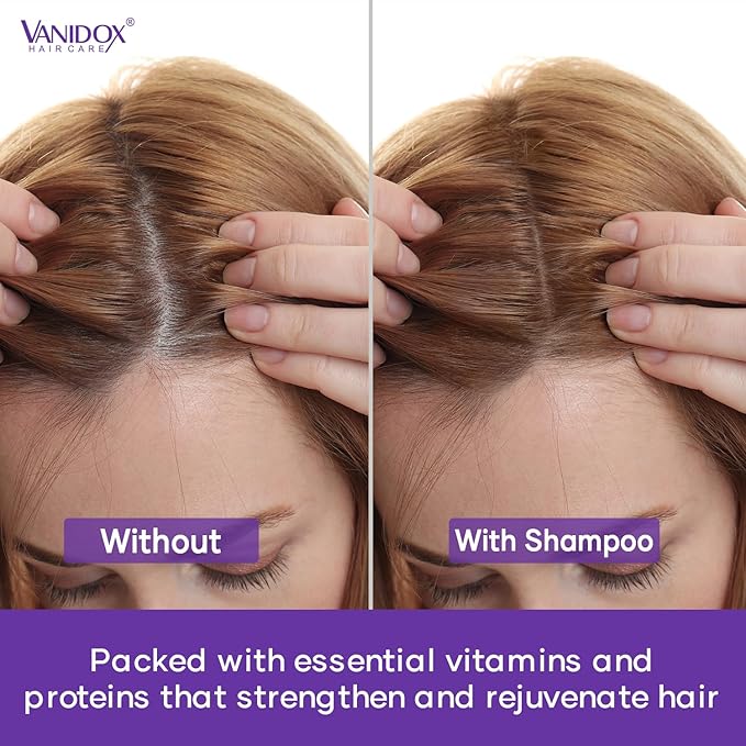 Tea Tree Shampoo and Conditioner Set with Lavender and Mint | DHT Blockers | With 100% Pure Tea Tree Oil for Itchy, Dry Scalp | Sulfate & Paraben Free | For Men & Women | 16 fl oz Each-VivaGrace Women