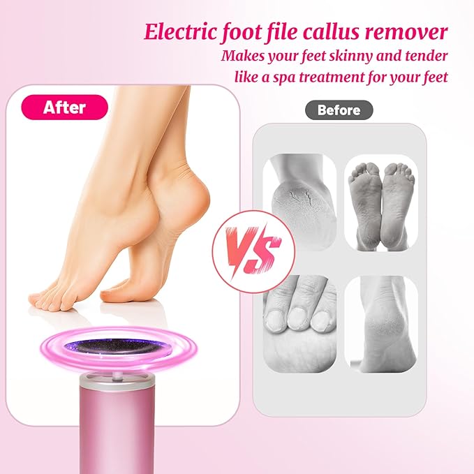 Electric Foot Callus Remover with 80pcs Sandpape Discs, Professional 800RPM Aluminum, Callus Remover for Feet Pedicure Tool for Dead Skin and Calluses, Stepless Speed Control Foot File 2 in 1-VivaGrace Women