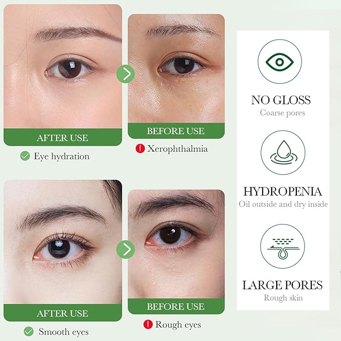 BIOAQUA Centella Asiatica Nourish Repair Eye Cream Soothing Oil Control Anti-Acne 20g / 0.7oz-VivaGrace Women