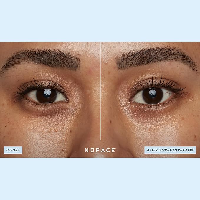 NuFACE IonPlex Hydra-Gel Power Under Eye Patches - Gel Under Eye Mask for Puffy Eyes & Dark Circles - Cooling Wrinkle Patches & Hydrating Treatment Pads to Energize, Brighten & Tighten (60 Count)-VivaGrace Women