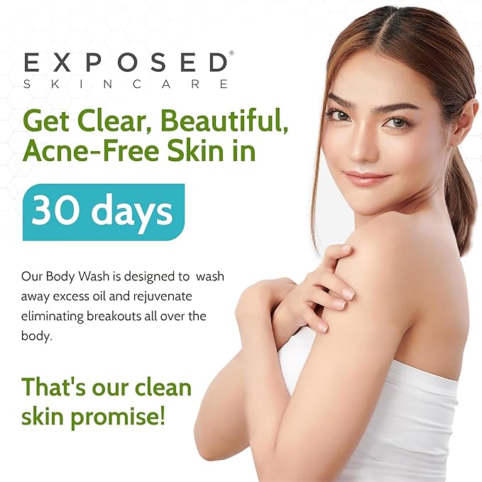 Exposed Skin Care Body Wash - Back and Body Acne Wash with Salicylic Acid and Tea Tree Oil – Exfoliating Bacne Treatment for Clearer, Healthier Skin – Body Cleanser for All Skin Types (12 fl oz)-VivaGrace Women